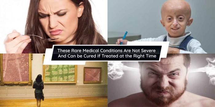 11 Rare Medical Conditions That May Occur in a Person of Any Age