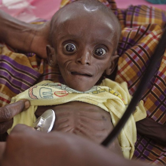15 Powerful Photos That Will Break Your Heart