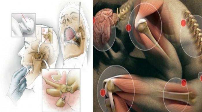 6 Worst Pains Ever Perceived by Humans
