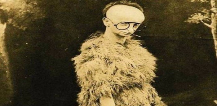 7 People With the Rarest of Human Oddities
