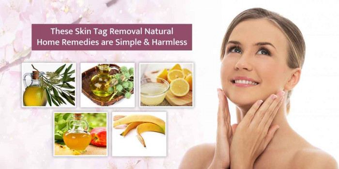 8 Amazingly Effective Natural Home Remedies for Removing Skin Tags