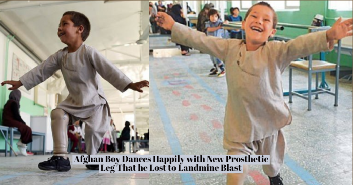 Afghan Boy Dances in Joy After Getting a New Artificial Limb! Do Watch