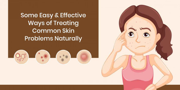 How to Treat Several Common Skin Problems the Simple & Natural Way