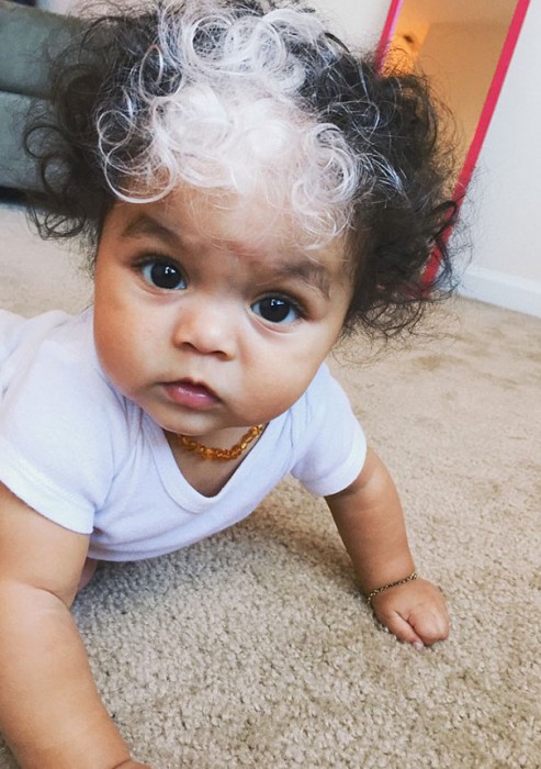 Little Girl's White Hair Patch Is Similar to Her Mother, Grandmother and Great Grandmother