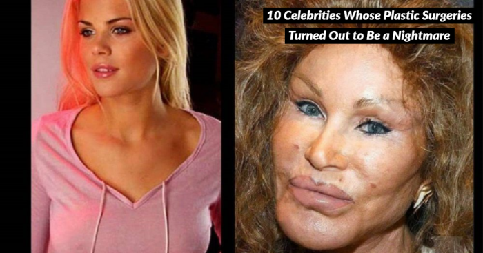 Look at These 10 Biggest Celebrity Plastic Surgery Disasters Ever