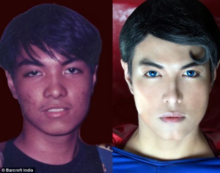 This Man Underwent 23 Surgeries For The Superman Look