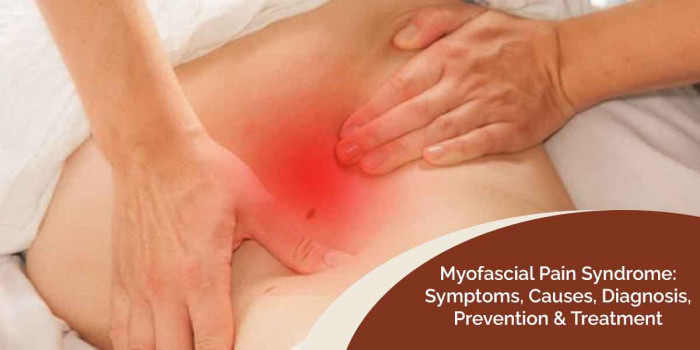 Understanding the Myofascial Pain Syndrome (or Muscle Pain)