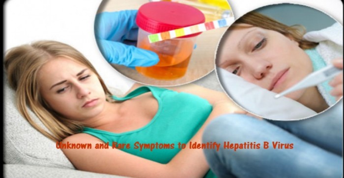 Symptoms, Causes, Diagnosis & Treatment of the Infectious Disease “Hepatitis B” Virus